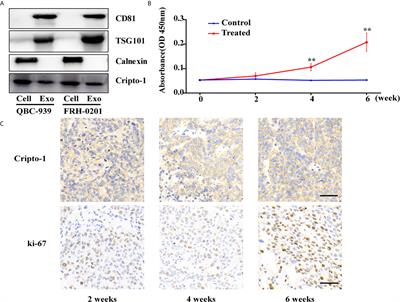 Exosomal Cripto-1 Serves as a Potential Biomarker for Perihilar Cholangiocarcinoma